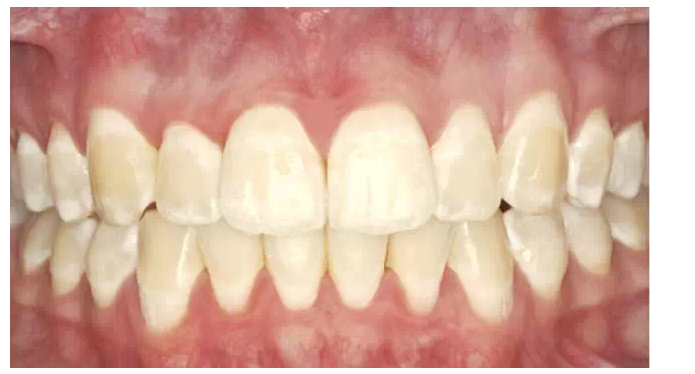 QQ圖片20150717174132.png QQ圖片20150717174132.png