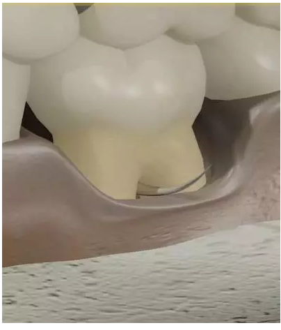 QQ圖片20150718100445.png QQ圖片20150718100445.png