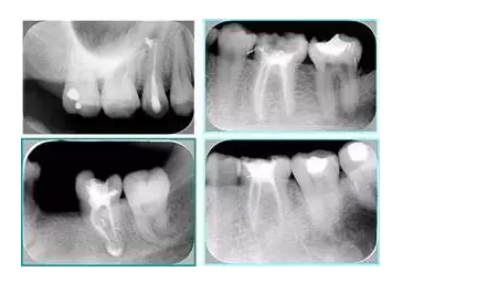 QQ圖片20150720110720.png QQ圖片20150720110720.png