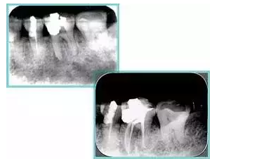 QQ圖片20150720110757.png QQ圖片20150720110757.png