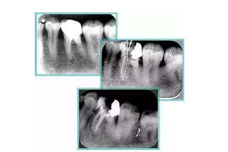 QQ圖片20150720110837.png QQ圖片20150720110837.png