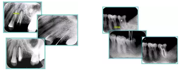 QQ圖片20150720110907.png QQ圖片20150720110907.png