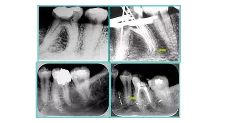 QQ圖片20150720110919.png QQ圖片20150720110919.png