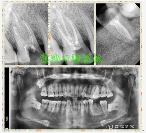 QQ圖片20150720103321.png QQ圖片20150720103321.png