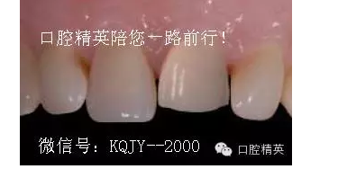 QQ圖片20150721093322.png QQ圖片20150721093322.png