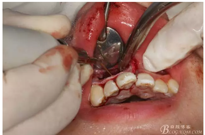 QQ圖片20150721155150.png QQ圖片20150721155150.png