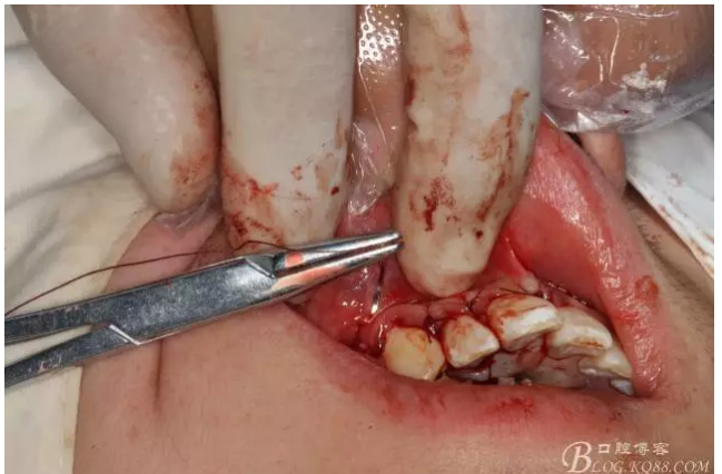 QQ圖片20150721155321.png QQ圖片20150721155321.png