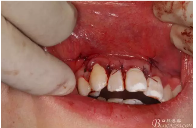 QQ圖片20150721155334.png QQ圖片20150721155334.png