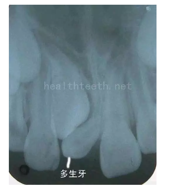 QQ圖片20150722094321.png QQ圖片20150722094321.png