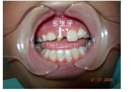 QQ圖片20150722094304.png QQ圖片20150722094304.png