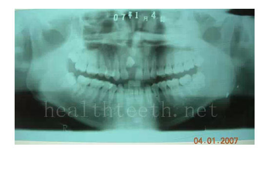 QQ圖片20150722094247.png QQ圖片20150722094247.png