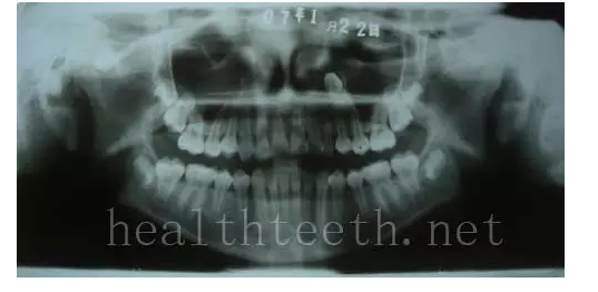 QQ圖片20150722094029.png QQ圖片20150722094029.png