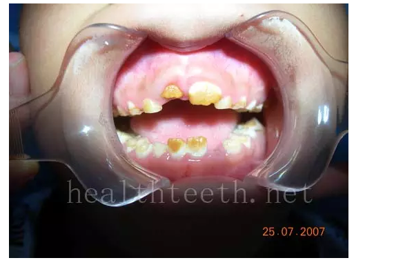 QQ圖片20150722094010.png QQ圖片20150722094010.png