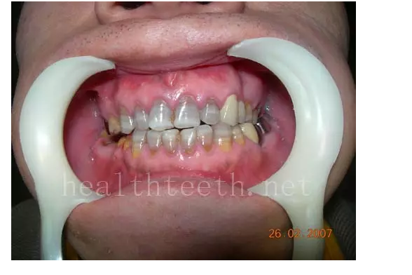 QQ圖片20150722093935.png QQ圖片20150722093935.png