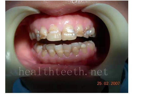 QQ圖片20150722093849.png QQ圖片20150722093849.png