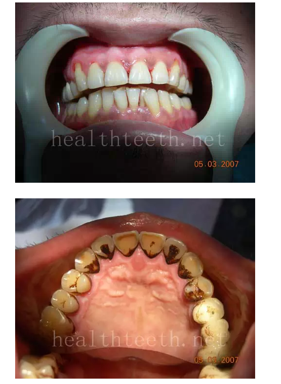 QQ圖片20150722093538.png QQ圖片20150722093538.png