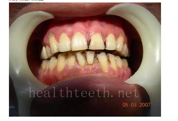 QQ圖片20150722093520.png QQ圖片20150722093520.png