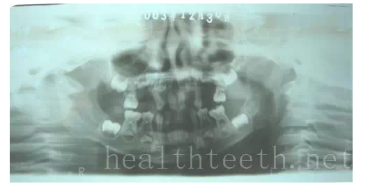 QQ圖片20150722093400.png QQ圖片20150722093400.png