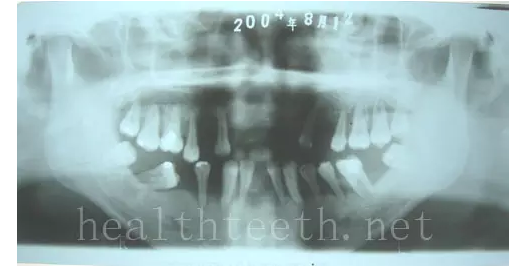 QQ圖片20150722093345.png QQ圖片20150722093345.png