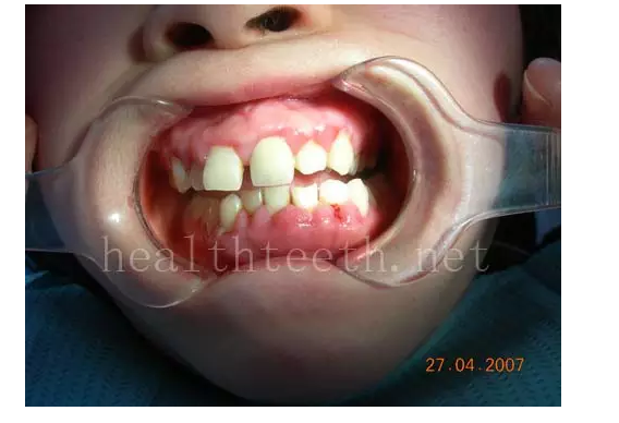 QQ圖片20150722093242.png QQ圖片20150722093242.png