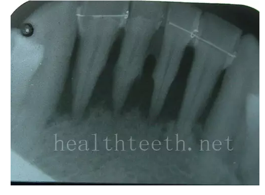 QQ圖片20150722093207.png QQ圖片20150722093207.png