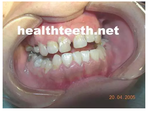 QQ圖片20150722093115.png QQ圖片20150722093115.png