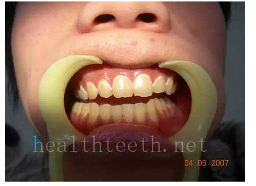 QQ圖片20150722093101.png QQ圖片20150722093101.png