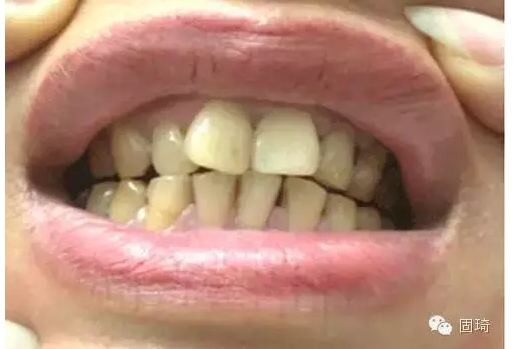 QQ圖片20150724134516.png QQ圖片20150724134516.png