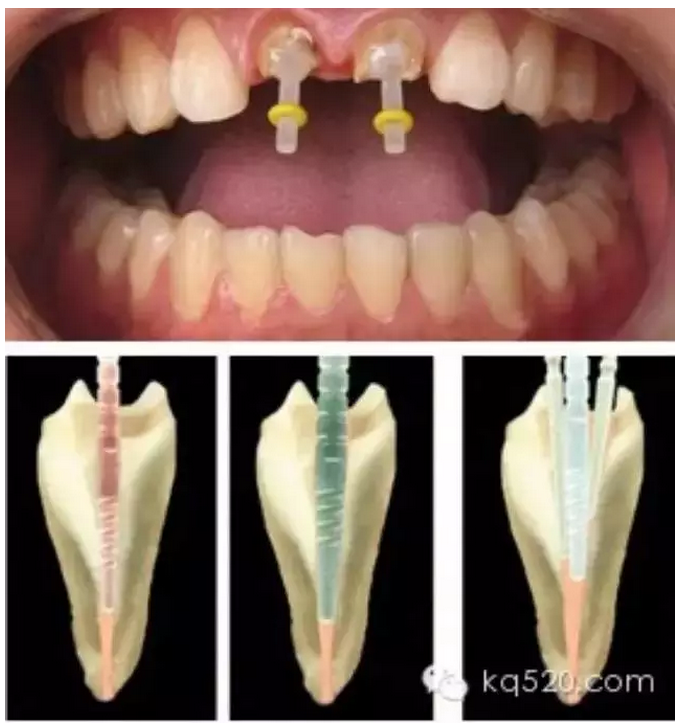 QQ圖片20150725102029.png QQ圖片20150725102029.png