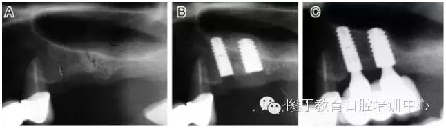 QQ圖片20150725105857.png QQ圖片20150725105857.png