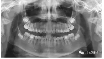 QQ圖片20150727085338.png QQ圖片20150727085338.png