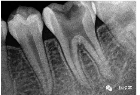 QQ圖片20150727085529.png QQ圖片20150727085529.png