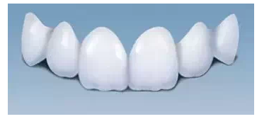 瓷貼面實戰(zhàn)流程 瓷貼面實戰(zhàn)流程