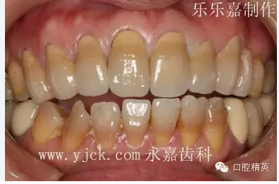 QQ圖片20150727150419.png QQ圖片20150727150419.png