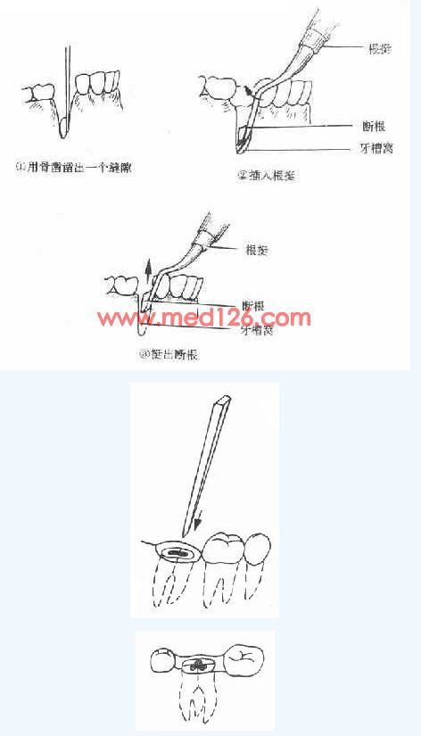 QQ圖片20150727154441.png QQ圖片20150727154441.png