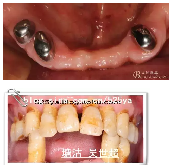 QQ圖片20150728084620.png QQ圖片20150728084620.png