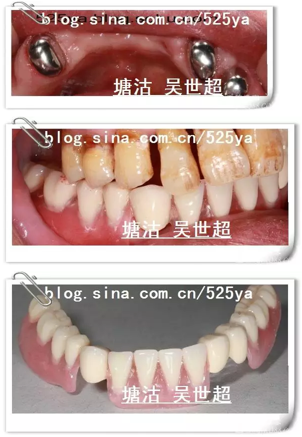 QQ圖片20150728084634.png QQ圖片20150728084634.png