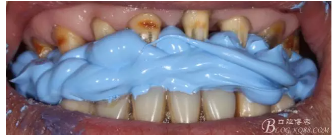 QQ圖片20150728084744.png QQ圖片20150728084744.png