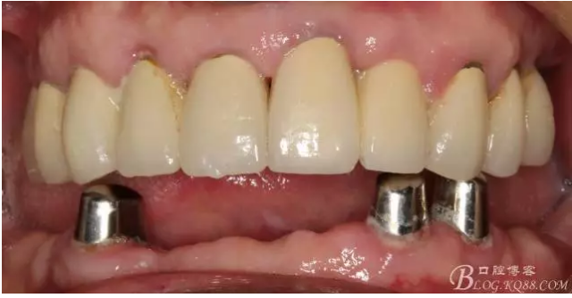 QQ圖片20150728084844.png QQ圖片20150728084844.png