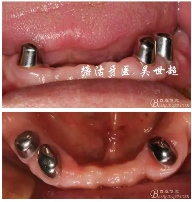 QQ圖片20150728084915.png QQ圖片20150728084915.png