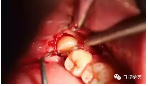 QQ圖片20150728093441.png QQ圖片20150728093441.png