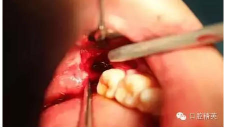 QQ圖片20150728093506.png QQ圖片20150728093506.png