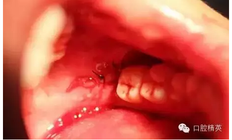 QQ圖片20150728093518.png QQ圖片20150728093518.png