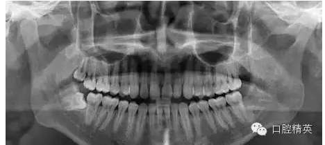 QQ圖片20150728093536.png QQ圖片20150728093536.png