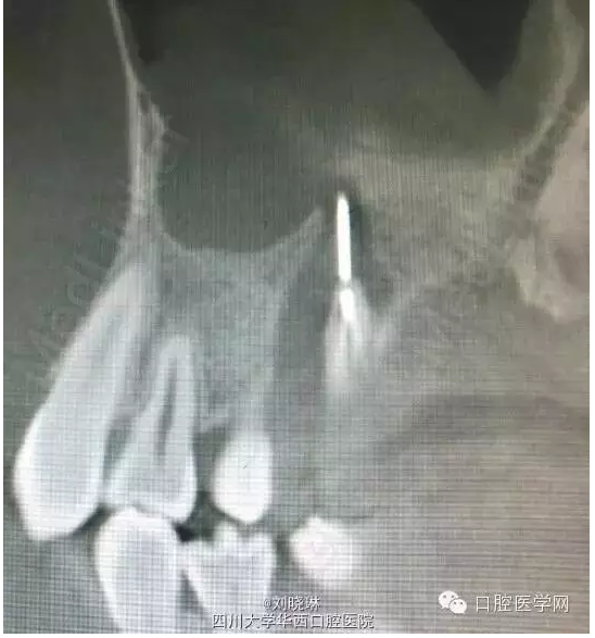 QQ圖片20150728144857.png QQ圖片20150728144857.png