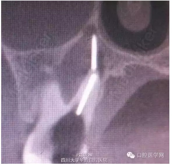 QQ圖片20150728144911.png QQ圖片20150728144911.png