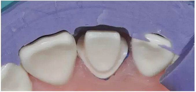 為什么你的牙齒備不好 為什么你的牙齒備不好