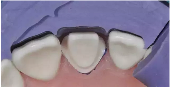 為什么你的牙齒備不好 為什么你的牙齒備不好