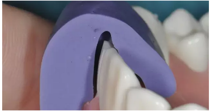 為什么你的牙齒備不好 為什么你的牙齒備不好