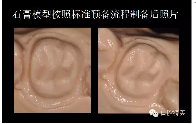 為什么你的牙齒備不好 為什么你的牙齒備不好